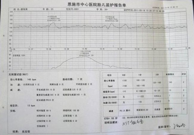 几个月查胎心，孕期胎心监测的重要性与时间表