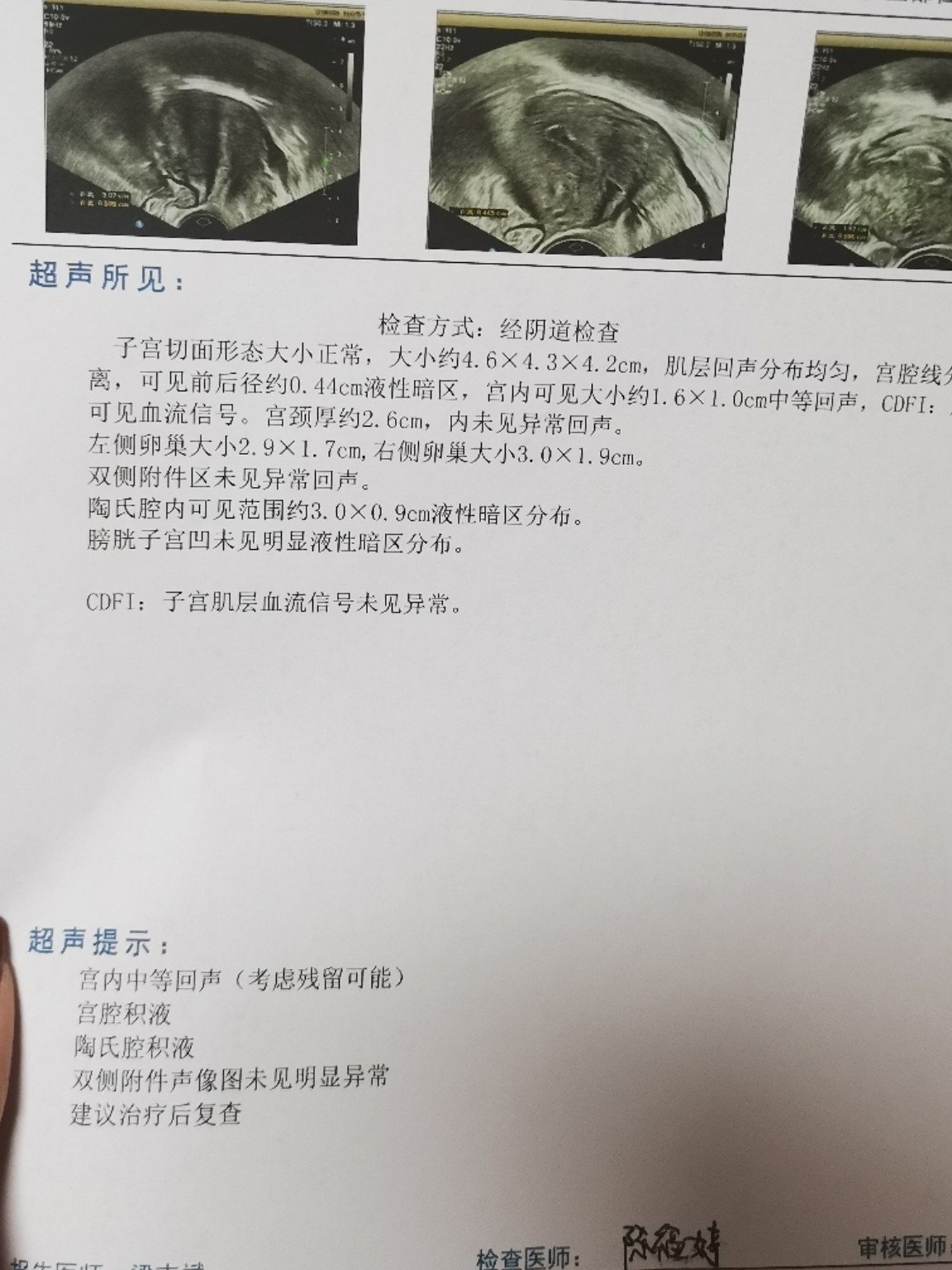 药流一个月后的残留问题及其处理策略