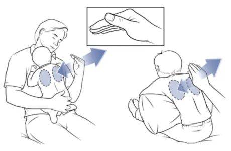 帮助排痰，针对两个月宝宝的痰问题解决方案
